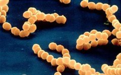 <b>霉菌感染的症状有哪些沐鸣1956代理</b>